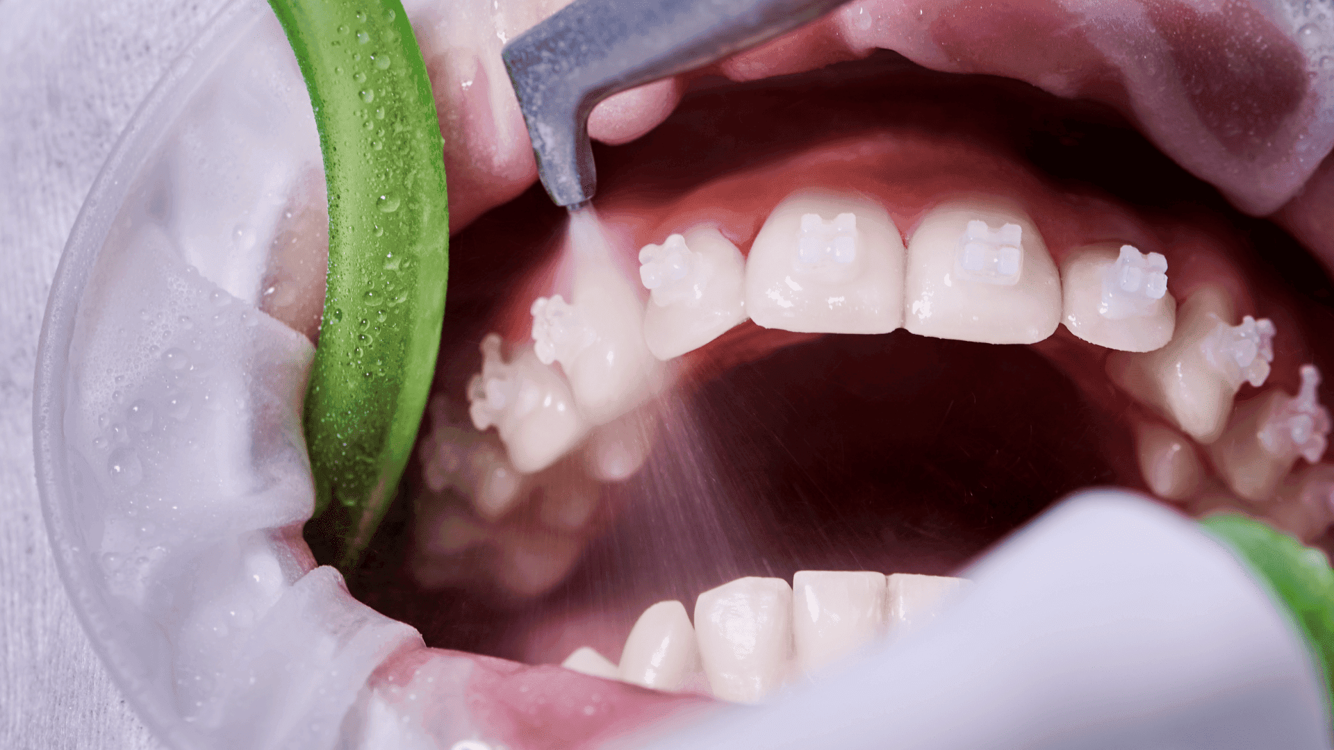 Profilaktyka i higienizacja