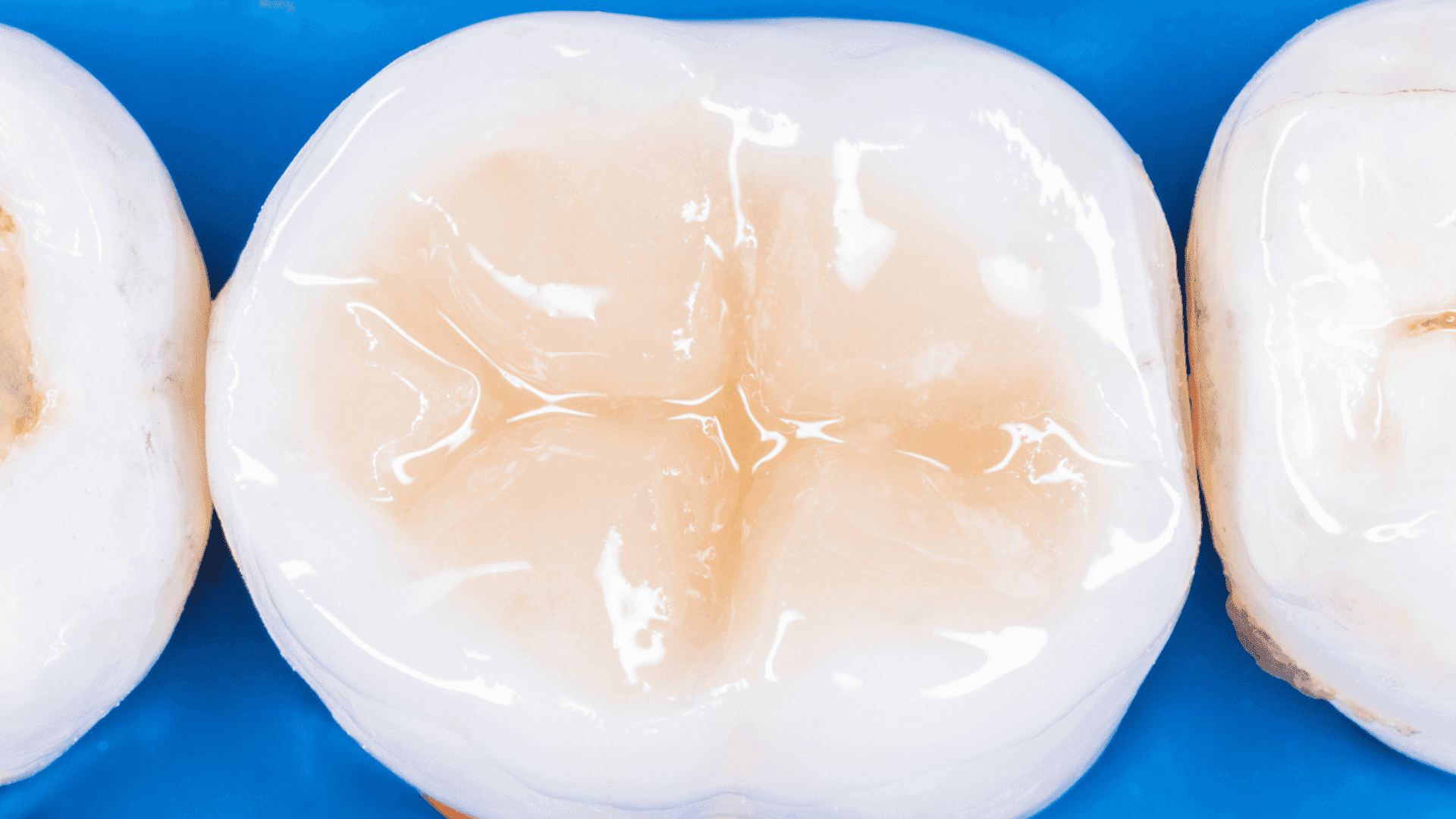 Estetyczna stomatologia zachowawcza