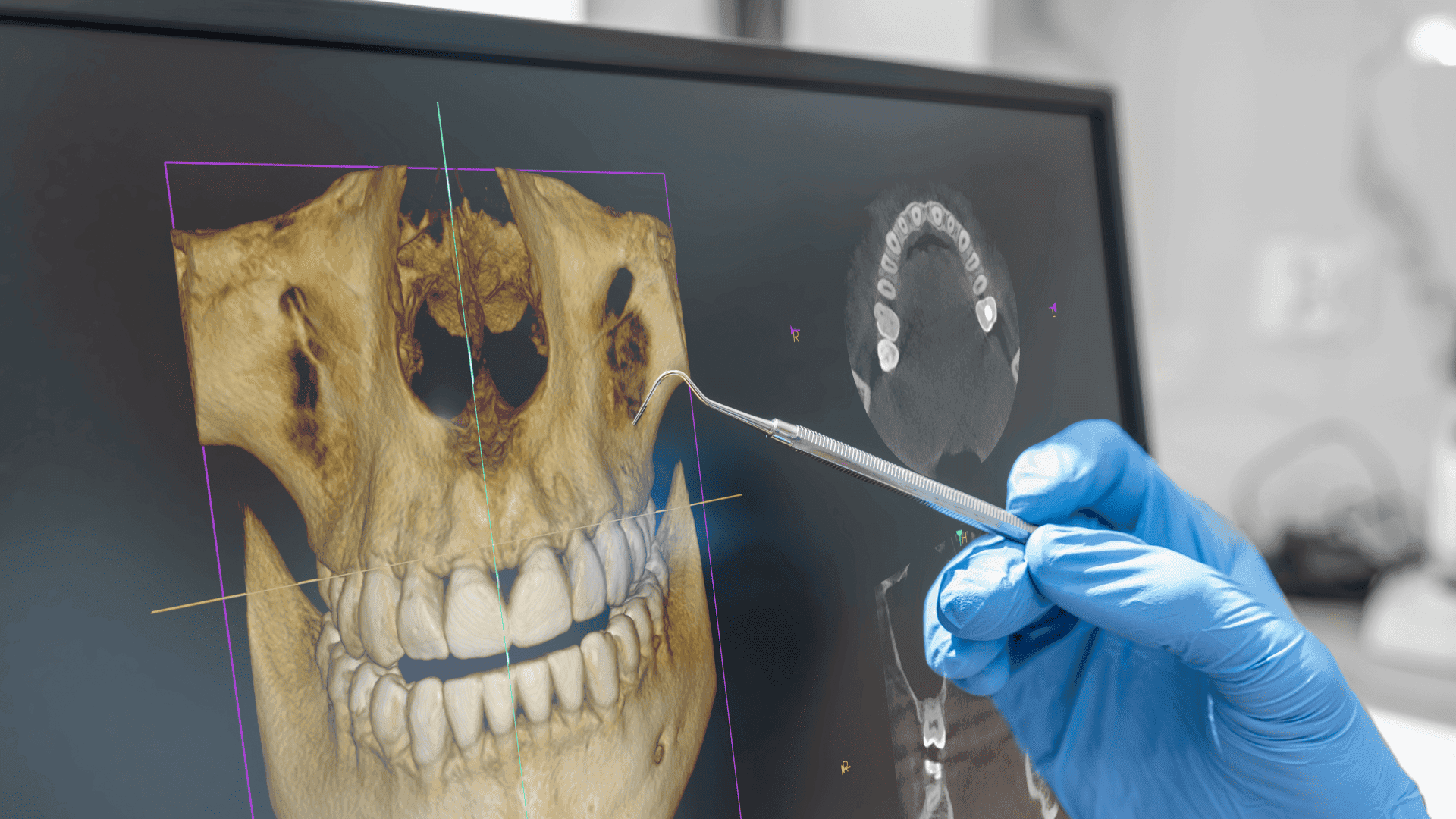 Zdjęcie Tomografia CBCT szczęka + żuchwa